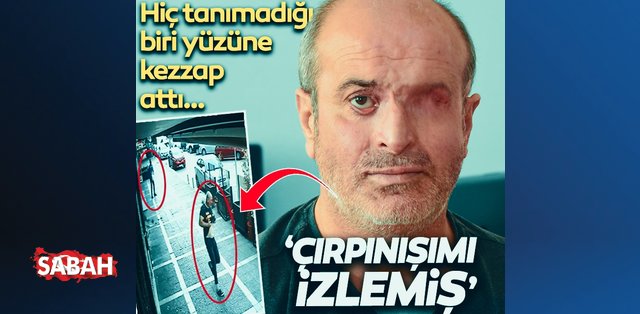 Son dakika: İzmir'de kan donduran olay! Hiç tanımadığı biri yüzüne kezzap attı: Çırpınışımı izlemiş...